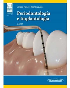 Periodontología E Implantología