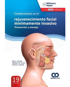 Complicaciones en el Rejuvenecimiento Facial Mínimamente Invasivo
