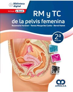 RM y TC de la Pelvis Femenina