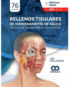 Rellenos Tisulares de Hidroxiapatita de Calcio