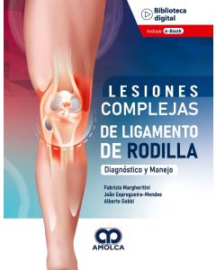 Lesiones Complejas de Ligamento de Rodilla