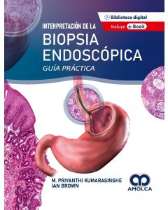 Interpretación de la Biopsia Endoscópica
