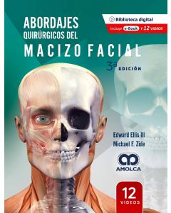 Abordajes Quirúrgicos del Macizo Facial