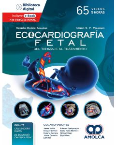 Ecocardiografía Fetal