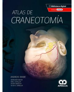Atlas de Craneotomía