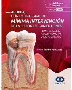 Abordaje Clínico Integral de Mínima Intervención de la Lesión de Caries Dental