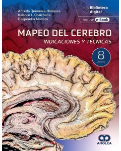Mapeo del Cerebro. Indicaciones y Técnicas