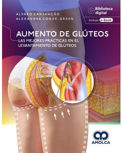 Aumento de Glúteos. Las Mejores Prácticas en el Levantamiento de Glúteos