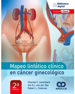 Mapeo Linfático Clínico en Cáncer Ginecológico