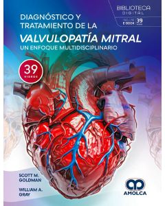 Diagnóstico y Tratamiento de la Valvulopatía Mitral