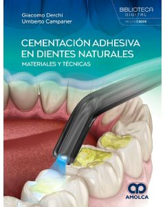 Cementación Adhesiva en Dientes Naturales