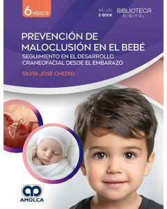 Prevención de Maloclusión en el Bebé. Seguimiento en el Desarrollo Craneofacial desde el Embarazo
