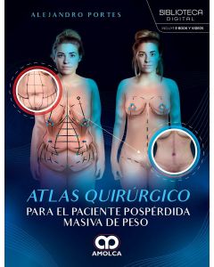 Atlas Quirúrgico para el Paciente Pospérdida Masiva de Peso