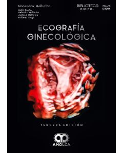 Ecografía ginecológica