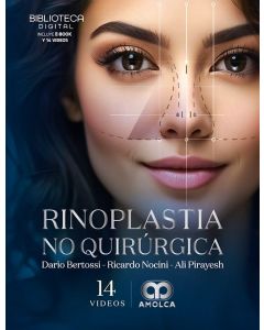 Rinoplastia No Quirúrgica
