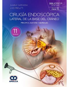 Cirugía Endoscópica Lateral de la Base del Cráneo
