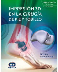 Impresión 3D en la Cirugía de Pie y Tobillo