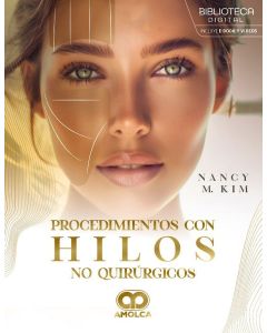 Procedimientos con Hilos No Quirúrgicos