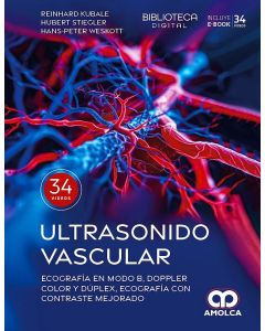 Ultrasonido Vascular.