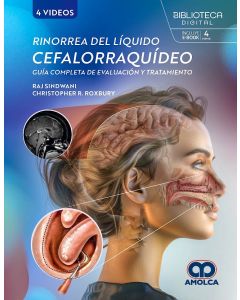 Rinorrea del Líquido Cefalorraquídeo