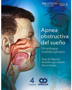 Apnea Obstructiva del Sueño