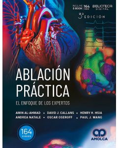 Ablación Práctica. El Enfoque de los Expertos