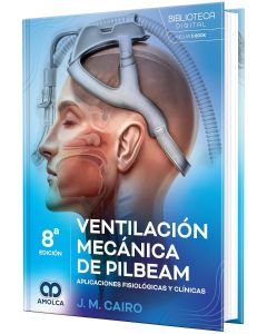 Ventilación Mecánica de Pilbeam