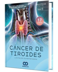 Cáncer de Tiroides. Masterclass Suite I-Oncology PET-CT-RM