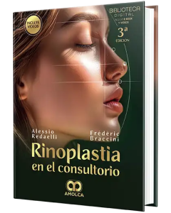 Rinoplastia en el Consultorio