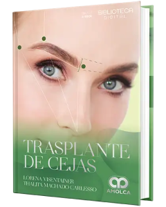 Trasplante de Cejas