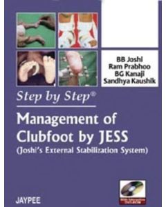 Step by Step Management of Clubfoot by Jess: Joshi's External Stabilization System