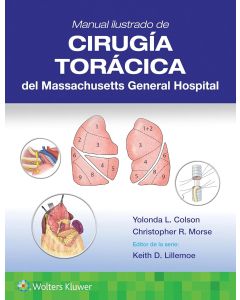 Manual ilustrado de Cirugía torácica del Massachusetts General Hospital