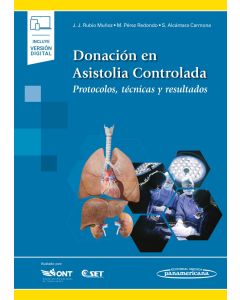 Donación en Asistolia Controlada