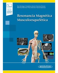 Resonancia Magnética Musculoesquelética