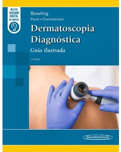 Dermatoscopia Diagnóstica. Guía Ilustrada