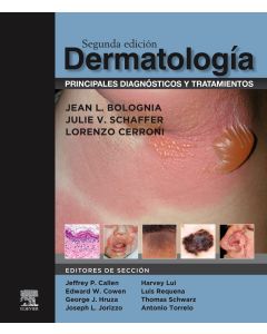 Dermatología. Principales Diagnósticos y Tratamientos