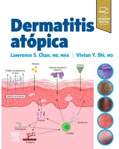 Dermatitis Atópica