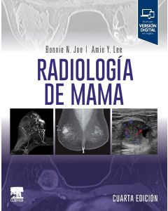 Radiología de Mama