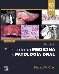 Cawson. Fundamentos de medicina y patología oral