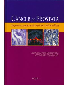 Cáncer de Próstata.