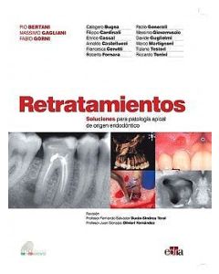 Retratamientos. Soluciones Para Patología Apical De Origen Endodóntico
