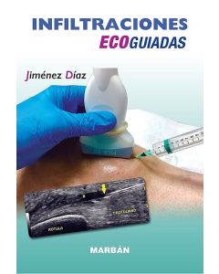 Infiltraciones Ecoguiadas