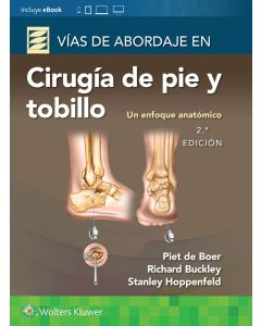 Vías de Abordaje de Cirugía de Pie y Tobillo
