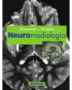 Neurorradiología