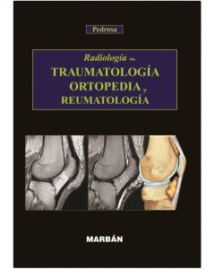 Radiologia En Traumatologia, Ortopedia Y Reumatolo