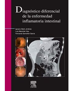 Diagnóstico diferencial de la enfermedad inflamatoria intestinal