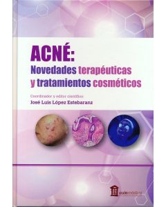 Acné. Novedades Terapéuticas y Tratamientos Cosméticos