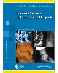 Lesiones Crónicas del Tobillo en el Deporte