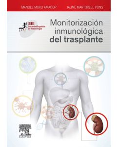 Monitorización inmunológica del trasplante