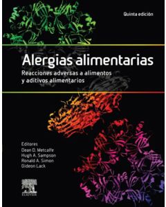 Alergias alimentarias. Reacciones adversas a alimentos y aditivos alimentarios